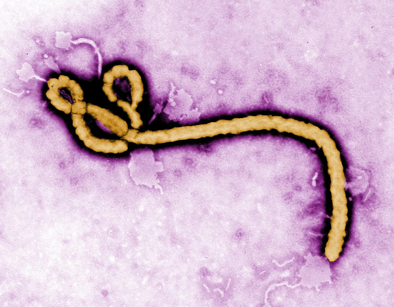 Related file image: Ebola virus (2)