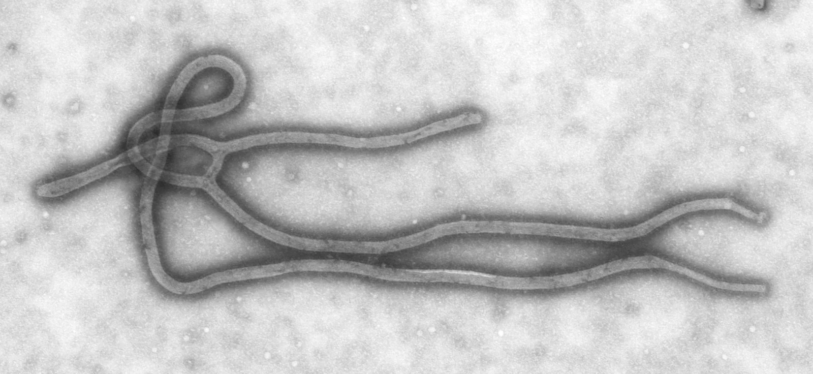 File image: Ebola virus particles in an electron micrograph
