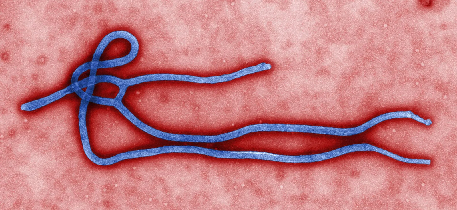 Related file image: Ebola virus virion